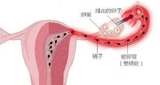 输卵管性不孕的症状