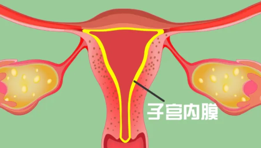 胚胎最爱在这样的内膜上着床！5招就能养出来