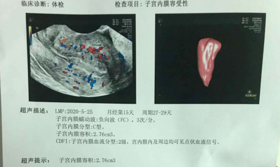 不着床？你确定你查了这4项？