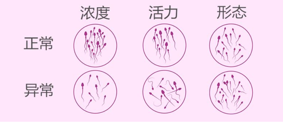 精子质量的关键指标，来读懂精液常规报告单