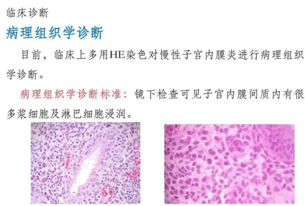 取子宫内膜痛不痛?有没有伤害? 