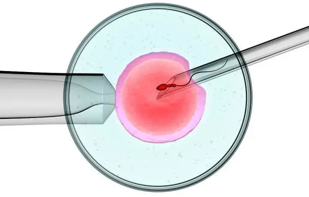 没有哪个医院做试管婴儿包成功，小心医托和骗子