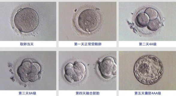 做试管婴儿，等级不好的胚胎要不要移植？