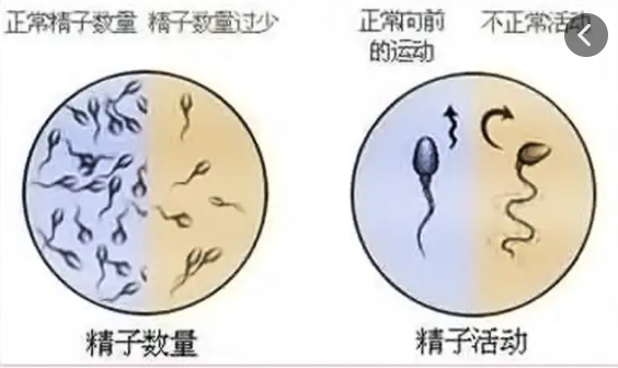 精子浓度低怎么改善调理