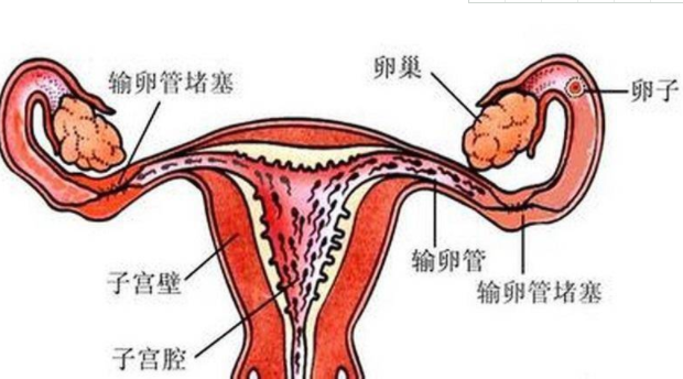 中药调理输卵管的原理是怎样的？应该怎么办？