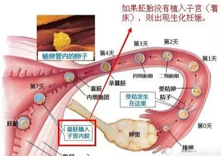 子宫内膜活检，做子宫内膜活检的目的是什么？