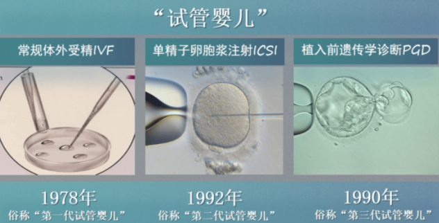 试管婴儿技术走到了哪一步？