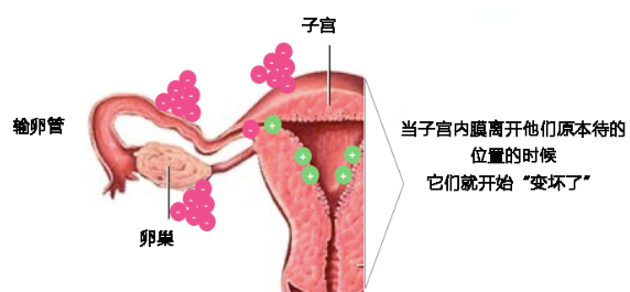 查血怎样诊断子宫内膜异位症？