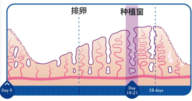 ERA对于反复移植失败的人是那颗“救星”么？