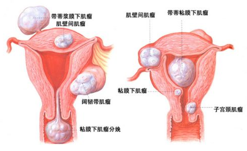 第三代试管婴儿成功率是多少