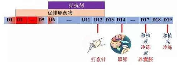 试管拮抗剂方案多久可以移植胚胎