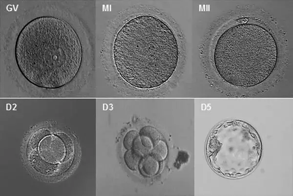 同天移植成功，为什么HCG值不一样？