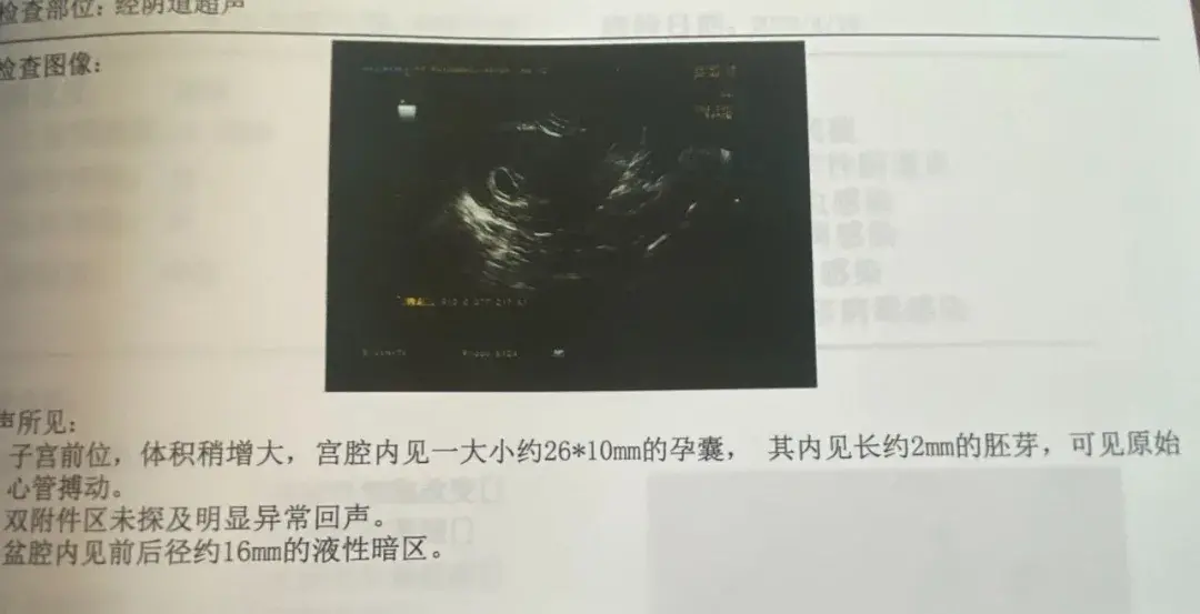 「孕路分享」看38岁卵巢功能减退的她如何一路升级做妈妈