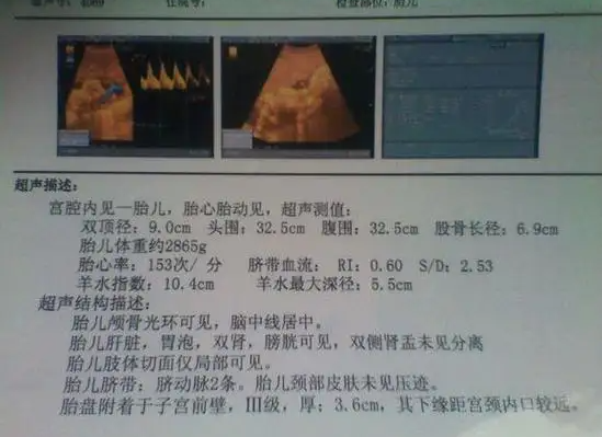 生男生女清宫表最新2022，B超单有这个一般是女孩