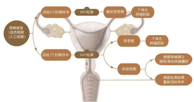 什么是子宫内膜容受性检测（ERT）？