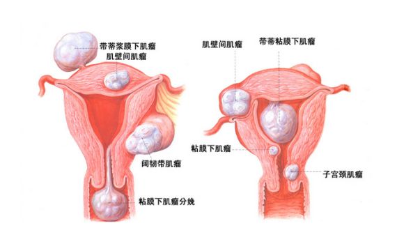 现在第三代试管婴儿生男孩需要多少费用？