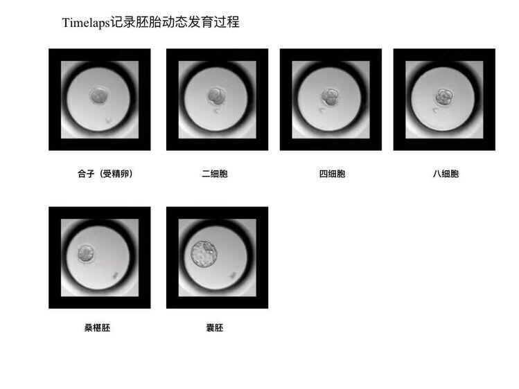 试管妈妈们：在成为母亲的途中，看见自己