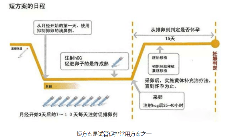 短方案试管步骤和时间？二代试管胎停的几率有多大？